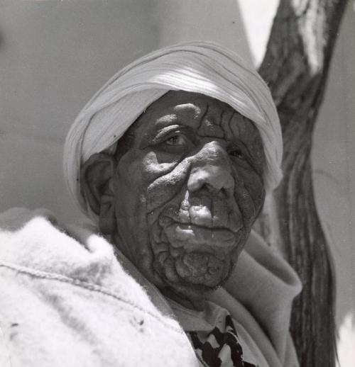 Leper in the hospital, Fez, Morocco
